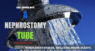 Showering with a Nephrostomy Tube: Tips and Precautions for Safety