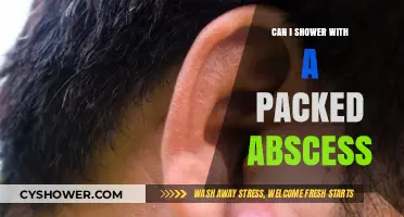 Showering with a Packed Abscess: Safe Practices and Precautions