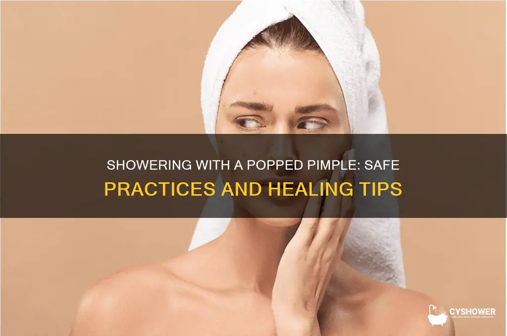 can i shower with a popped pimple