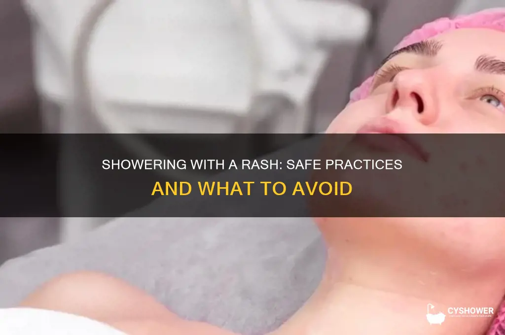 can i shower with a rash