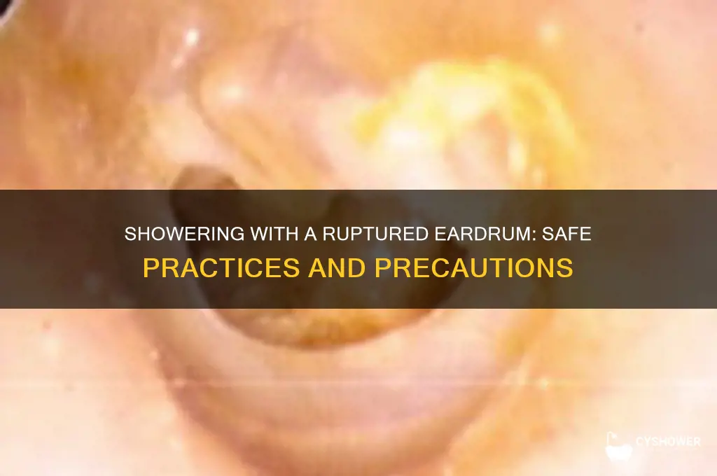can i shower with a ruptured ear drum