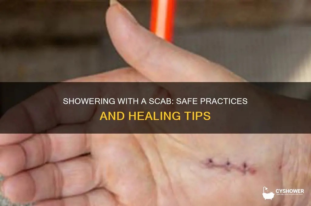 can i shower with a scab