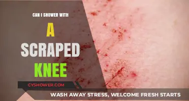 Scraped Knee Shower Guide: Safe Practices for Healing Wounds