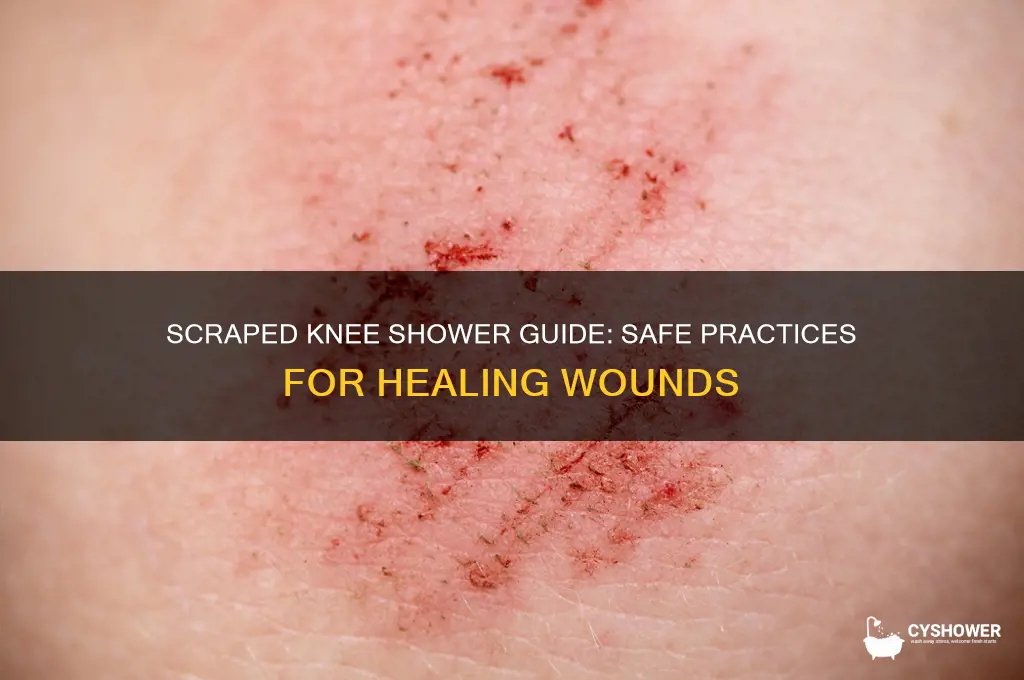 can i shower with a scraped knee