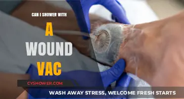 Showering with a Wound Vac: Safe Practices and Essential Tips