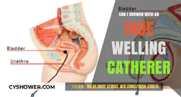 Showering with an Indwelling Catheter: Safety Tips and Best Practices