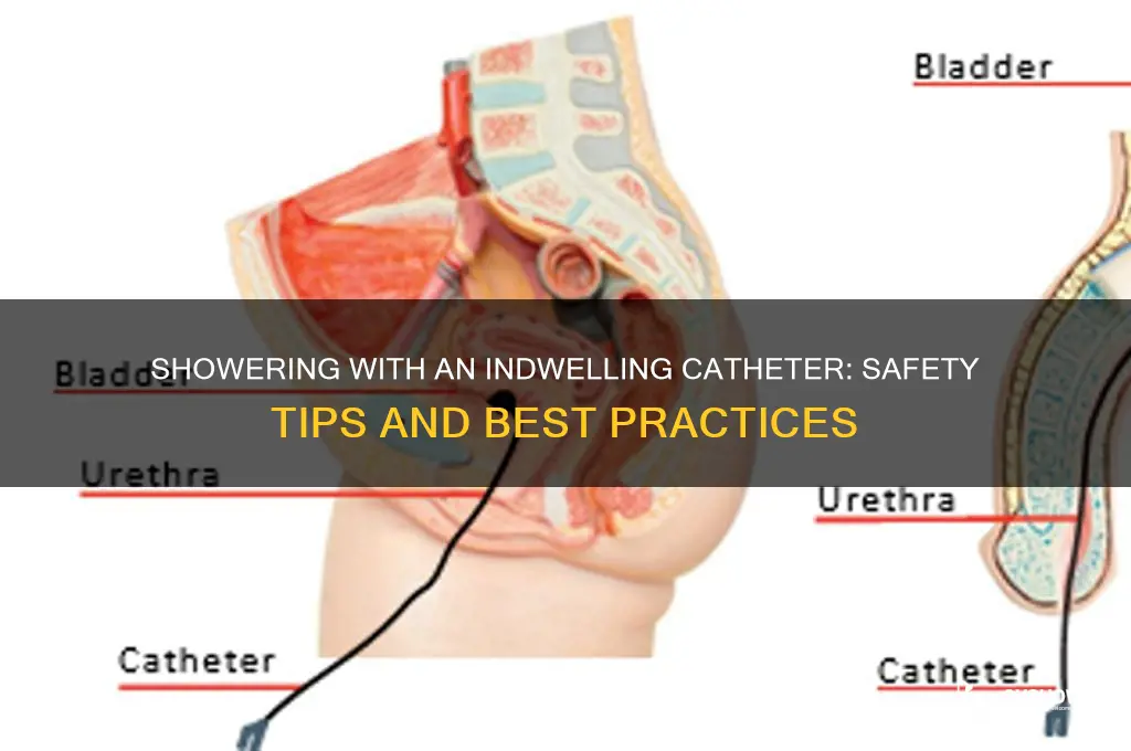 can i shower with an inde welling catherer