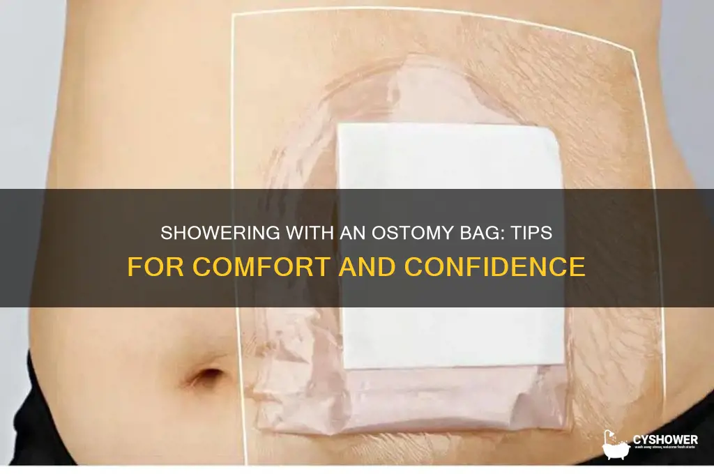 can i shower with an ostomy bag