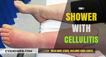 Showering with Cellulitis: Safe Practices and Precautions to Follow