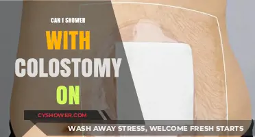 Showering with a Colostomy: Tips for Comfort and Confidence