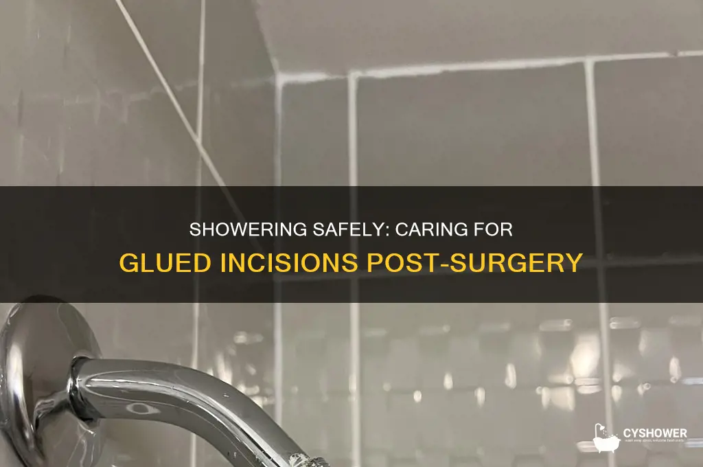 can i shower with glued incisions