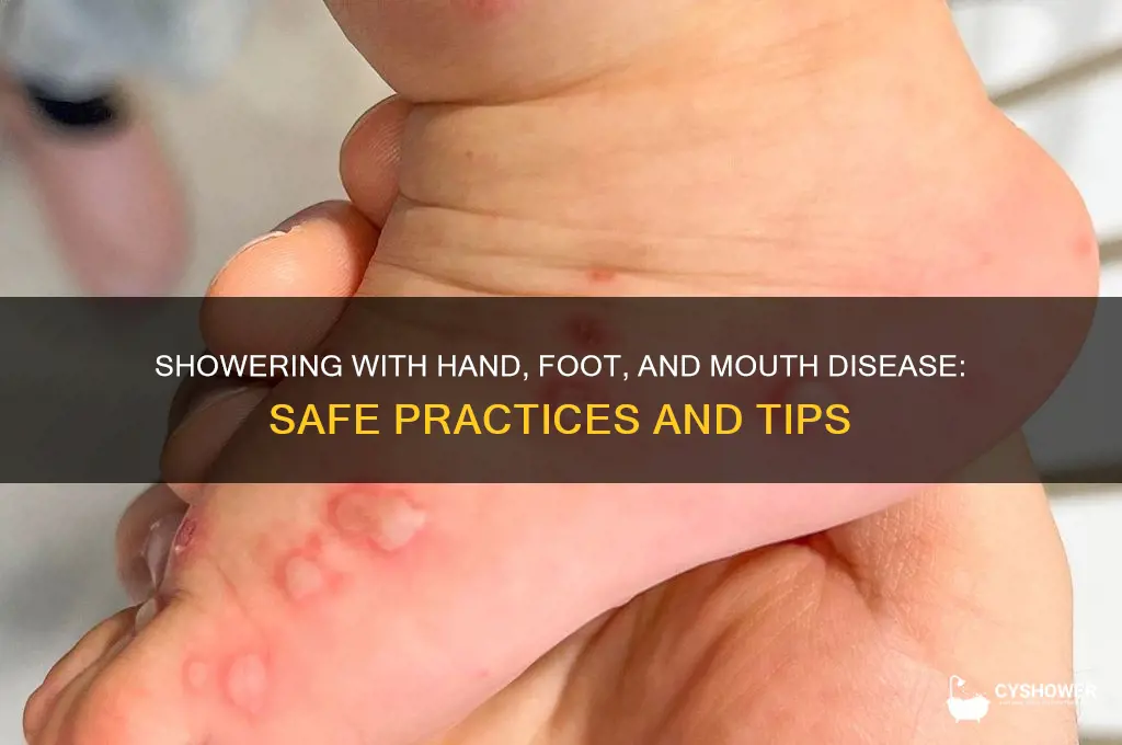 can i shower with hand foot and mouth