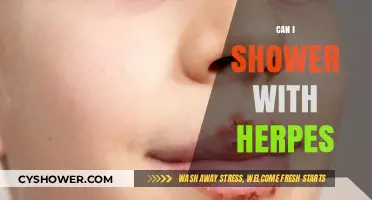 Showering with Herpes: Safe Practices and What You Need to Know