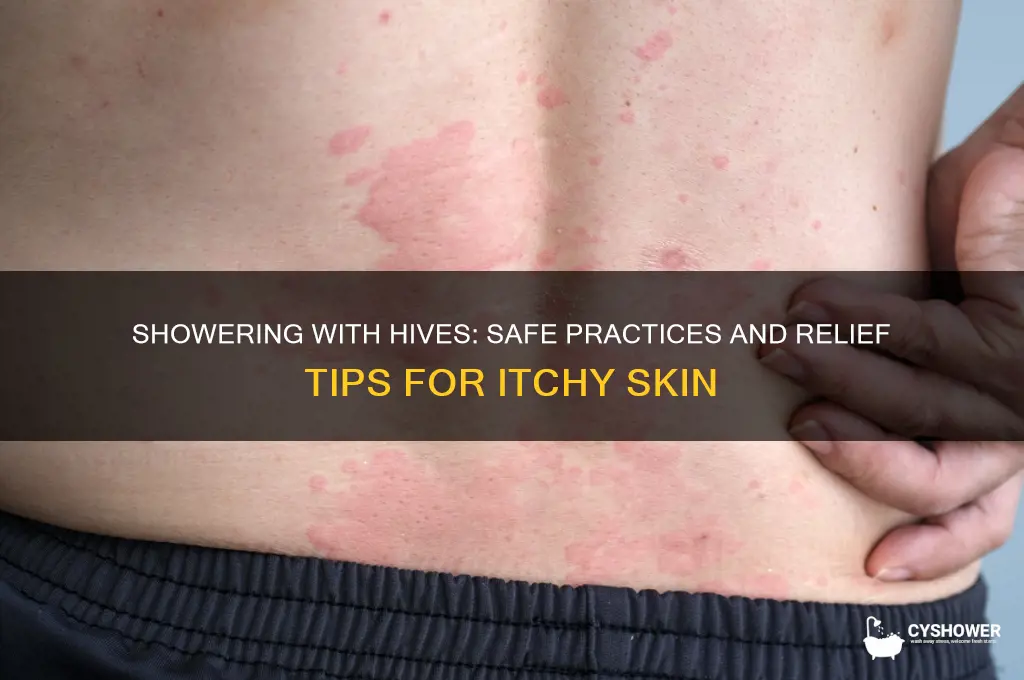 can i shower with hives