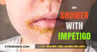 Showering with Impetigo: Safe Practices and Precautions to Prevent Spread