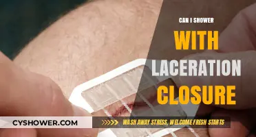 Showering with a Laceration Closure: Safe Practices and Tips