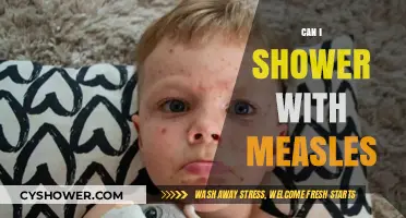 Showering with Measles: Safe Practices and Precautions to Consider