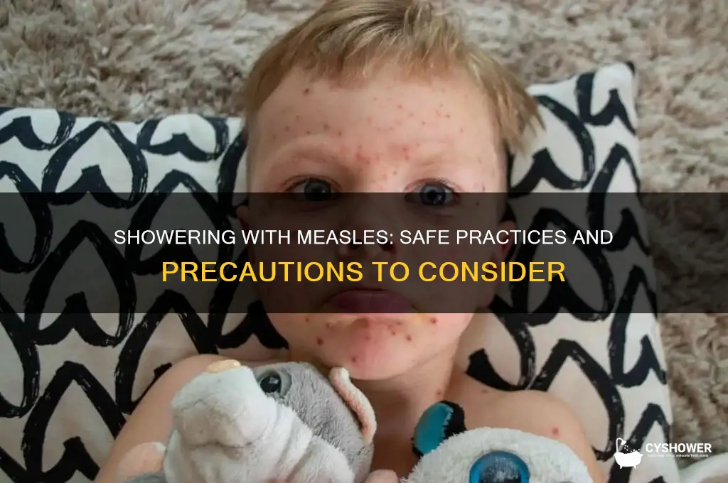 can i shower with measles