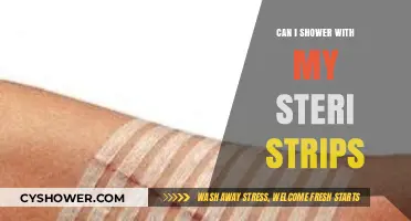 Showering with Steri-Strips: Safe Practices and Post-Surgery Care Tips