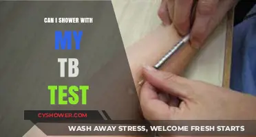 Showering After a TB Test: What You Need to Know