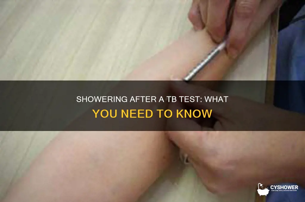 can i shower with my tb test