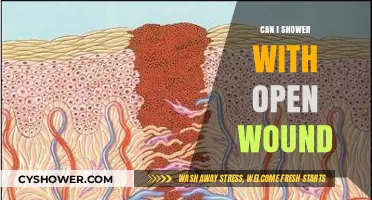 Showering with an Open Wound: Safe Practices and Precautions