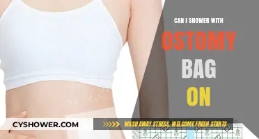 Showering with an Ostomy Bag: Tips for Comfort and Confidence