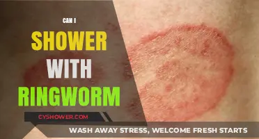 Showering with Ringworm: Safe Practices and Prevention Tips