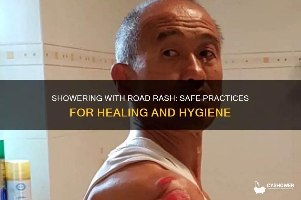 can i shower with road rash