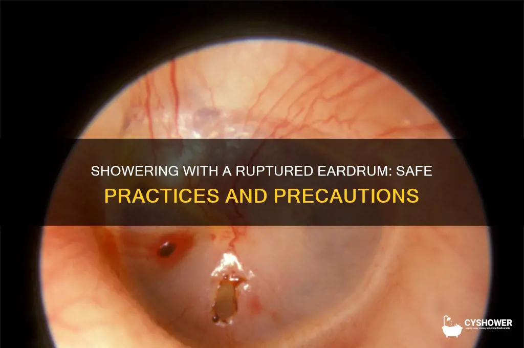 can i shower with ruptured eardrum