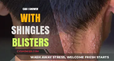 Showering with Shingles Blisters: Safe Practices and Precautions to Consider