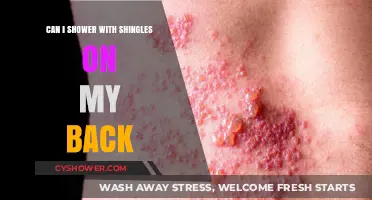 Showering with Shingles: Safe Practices for Back Relief and Care