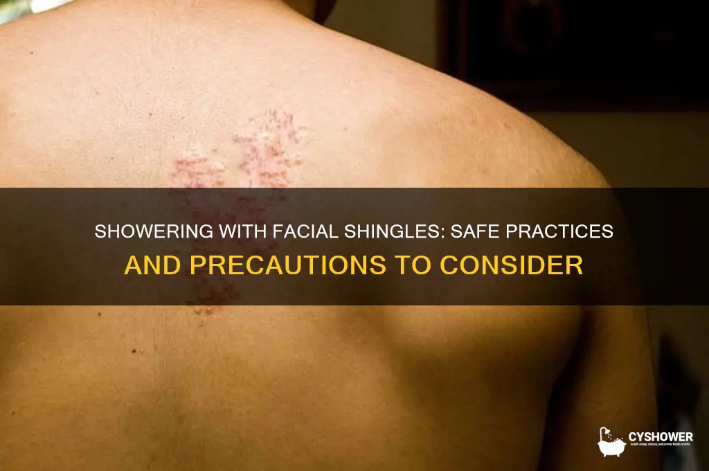 can i shower with shingles on my face