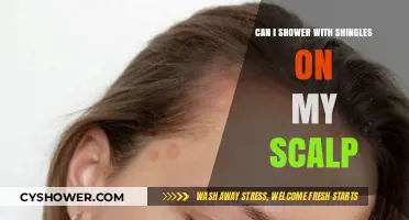 Showering with Scalp Shingles: Safe Practices and Tips for Relief