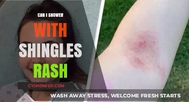 Showering with Shingles Rash: Safe Practices and Precautions to Consider
