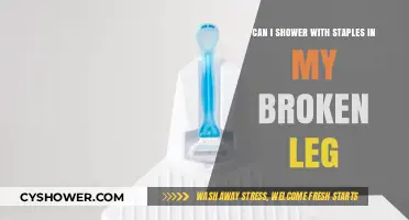 Showering with Staples in a Broken Leg: Safe or Risky?