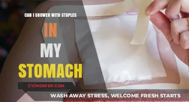 Showering with Staples in Stomach: Safe or Risky Post-Surgery?