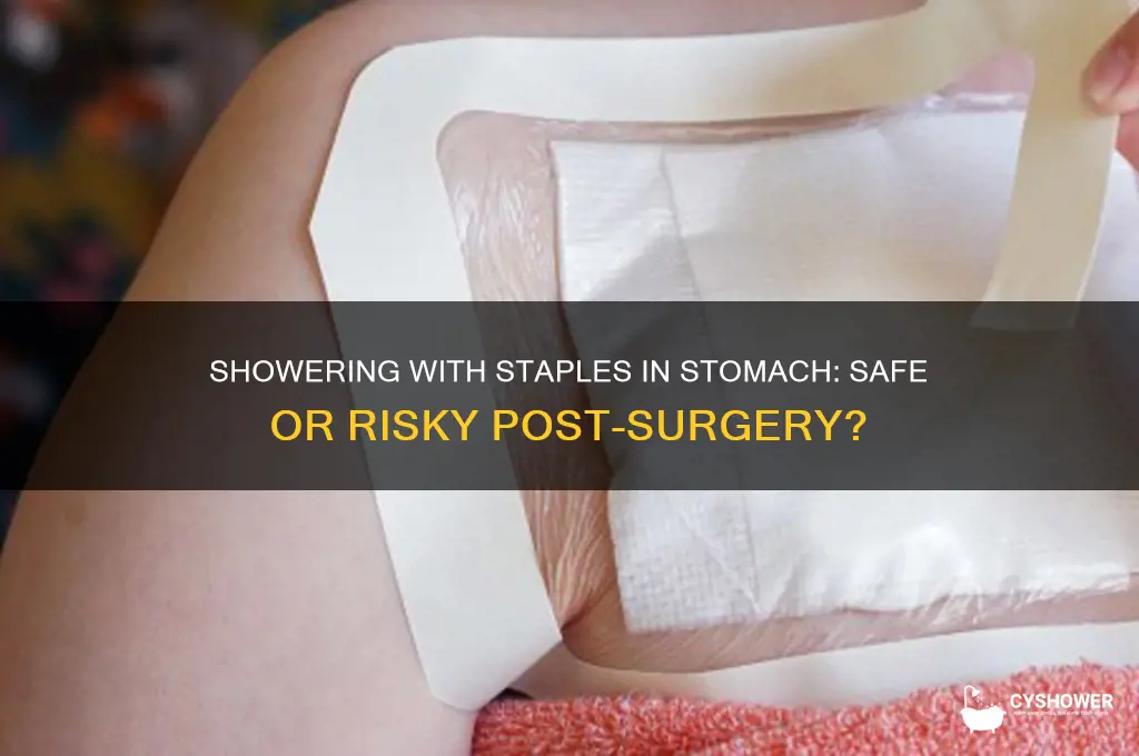can i shower with staples in my stomach