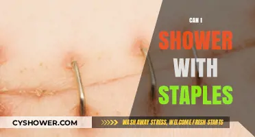 Showering with Staples: Safe Practices and Healing Tips Post-Surgery