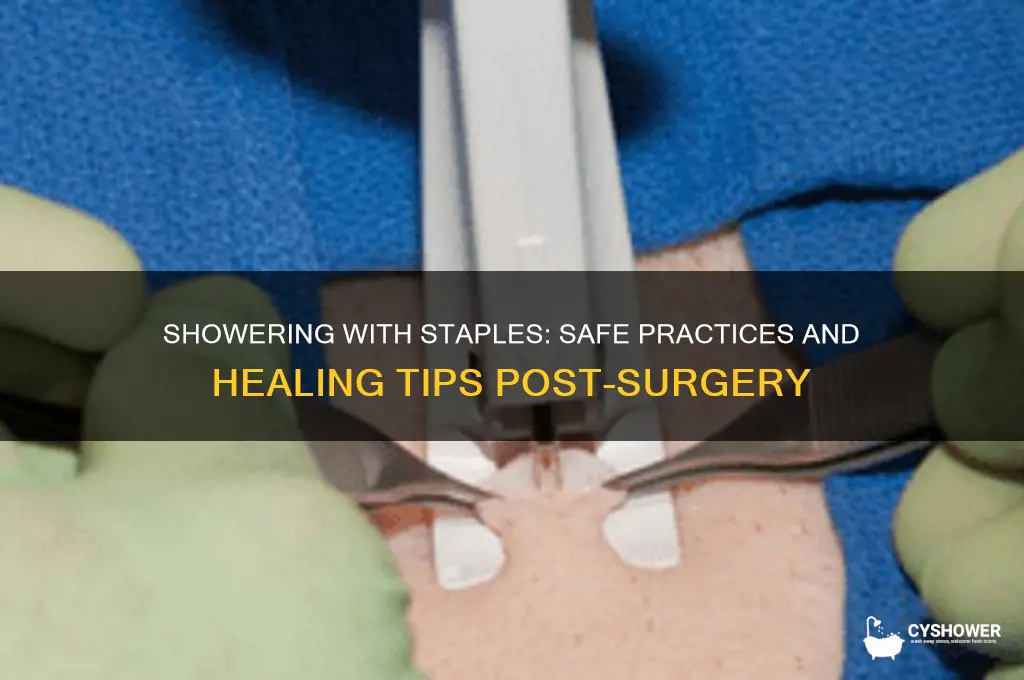 can i shower with staples