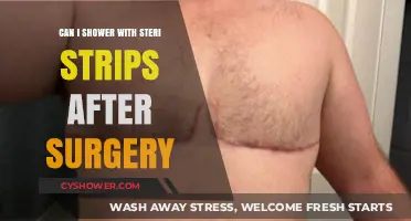 Post-Surgery Showering: Steri-Strips Care and Water Safety Tips