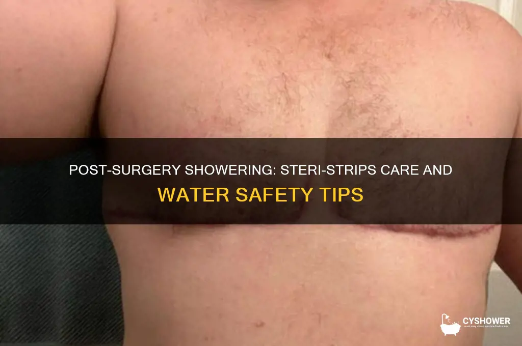 can i shower with steri strips after surgery
