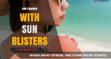 Showering with Sun Blisters: Safe Practices and Healing Tips