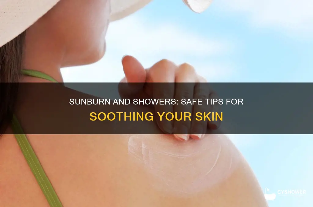 can i shower with sunburn