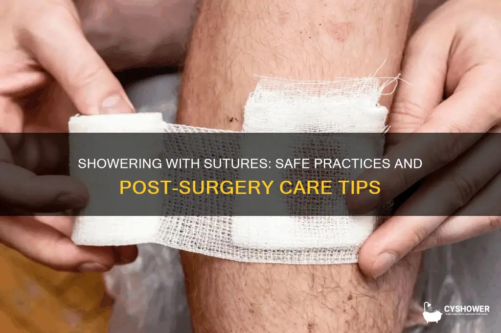 can i shower with sutures