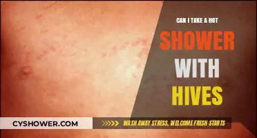 Hot Showers and Hives: Safe or Skin Irritation Risk?