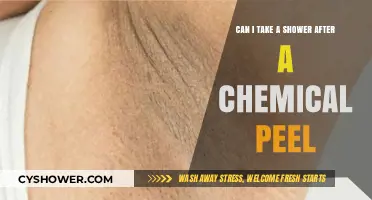 Showering After a Chemical Peel: What You Need to Know