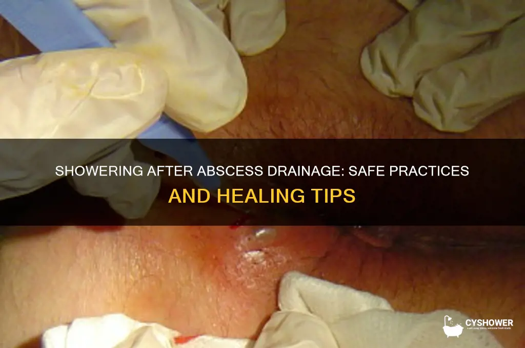 can i take a shower after abscess drainage