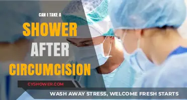 Post-Circumcision Shower Guide: When and How to Safely Cleanse
