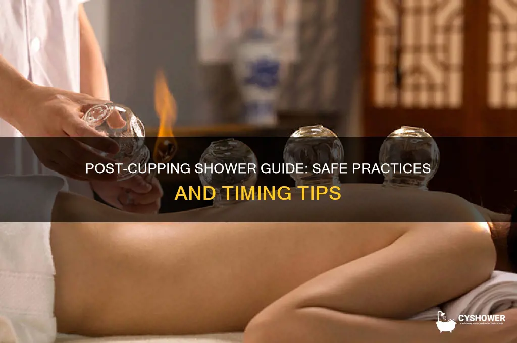 can i take a shower after cupping